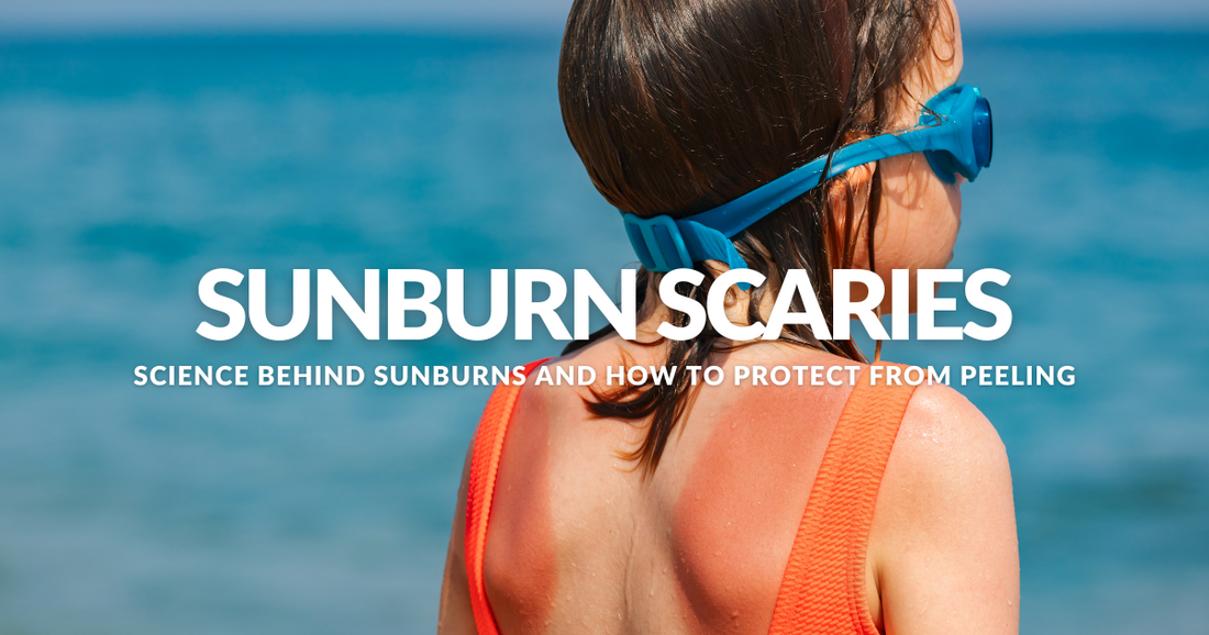 Sunburn scaries Science Behind Sunburns and How to Protect From Peeling